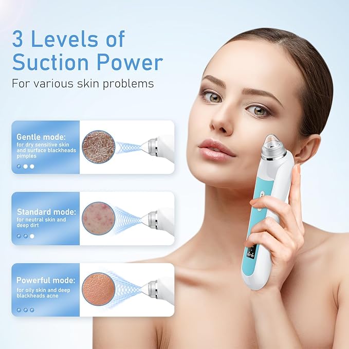 Facial Pore Blackhead Remover Vacuum, 1080P Camera Blackhead Remover, 20x Zoom, 8 LEDs ＆ 3 Suction Modes, 800mAh Battery & USB - 6 Heads Pore Cleaner Kit for Women&Men(Blue)-Velvo Beauty