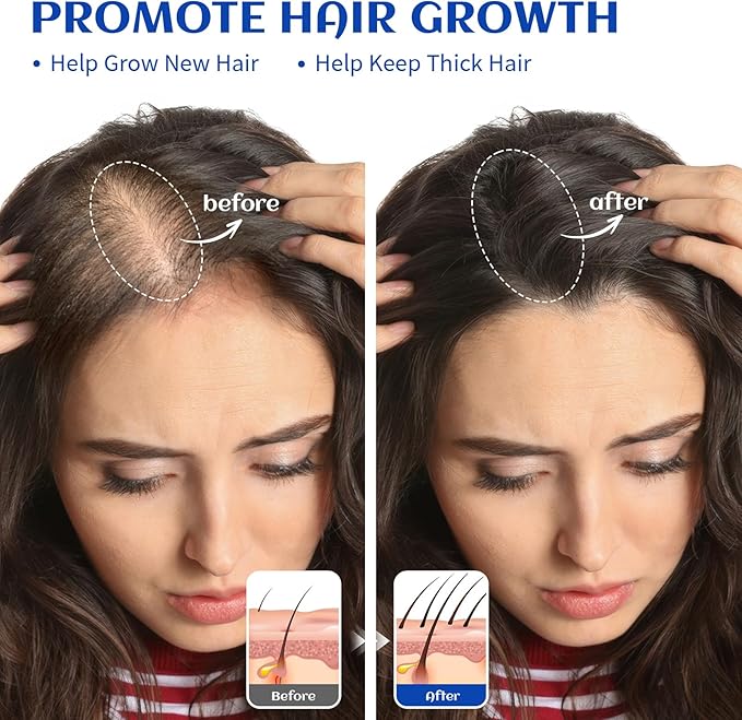 HIQILI Rosemary Oil for Hair Growth, Add to Shampoo & Conditioner, 100% Pure Undiluted - 16 Fl Oz-Velvo Beauty