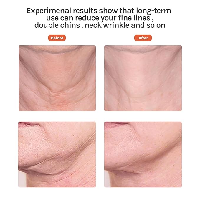 Ms.W Red Light Facial Massager, Face Massager Tool for Skin Care with LED, Thermal, and Vibration,Tightenings and Rejuvenation for Face and Neck-Velvo Beauty