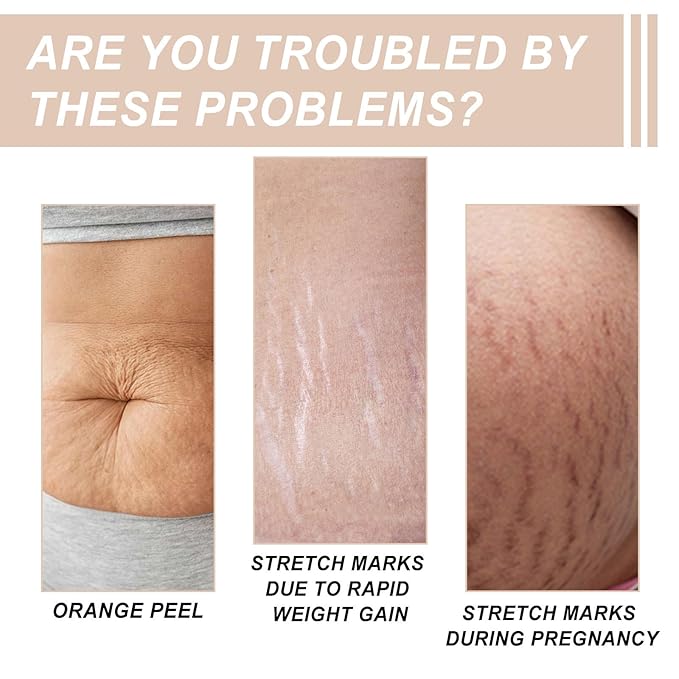 Butter Drench Restorative Rich Face Cream, Reduces Pregnancy Repair Skin, Hydrating Face Lotion, Helps Skin Retain Moisture, Soothes Dry Skin-Velvo Beauty