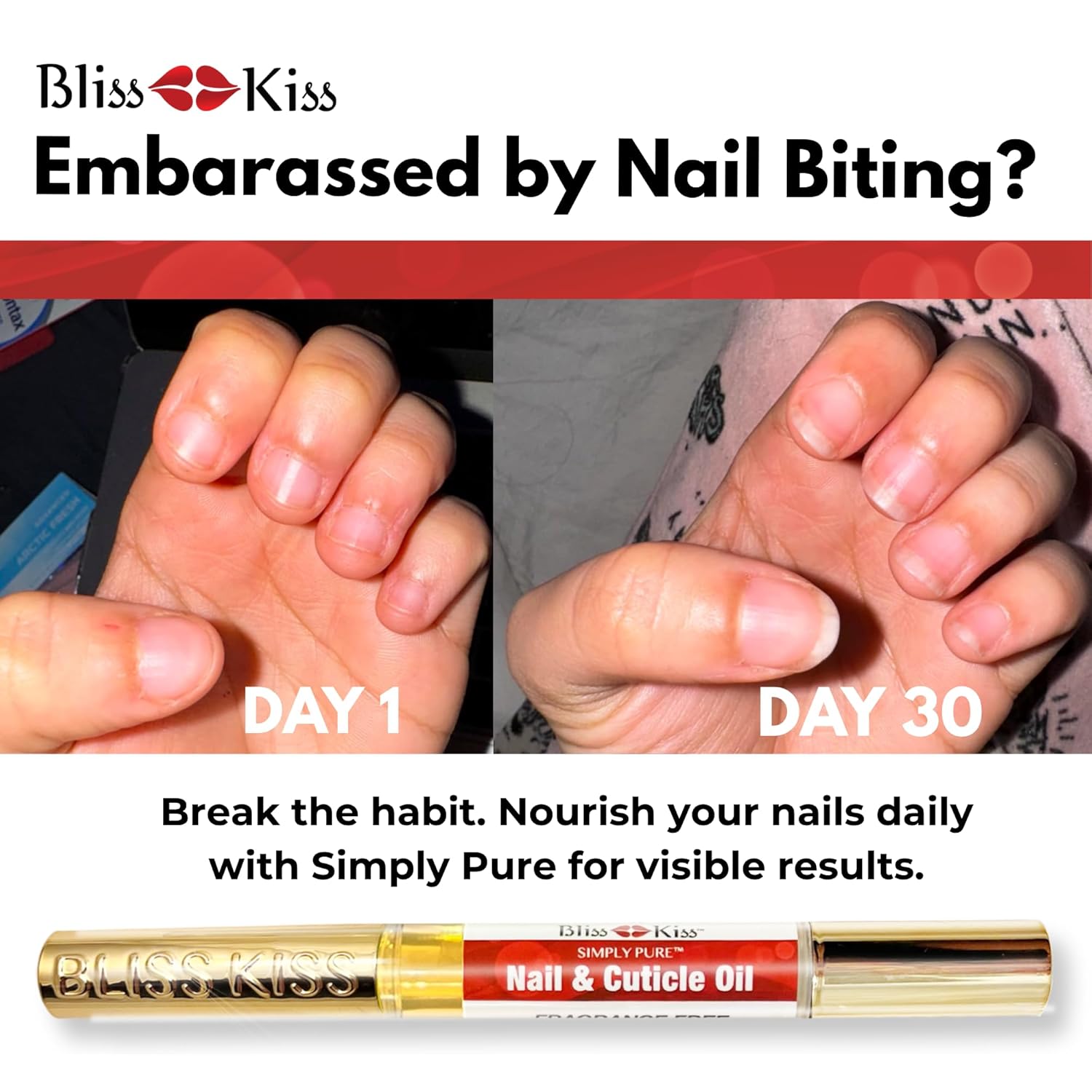 Bliss Kiss | 1 Fragrance Free | Nail Oil Cuticle Pen w/Vitamin E & Jojoba⏤Nail Strengthener Nail Growth Serum for Brittle Peeling Breaking Thin Nails-Velvo Beauty