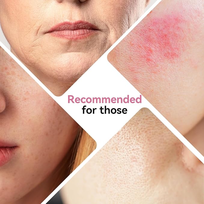 ISTON Bio-Collagen Face Mask,Overnight Revitalizing Hydrating Face Mask for Glowing Skin | Visible Firming, Deep Hydration & Refined Pores | Peptides, NMN & Hyaluronic Acid Masks For All Skin Type-Velvo Beauty