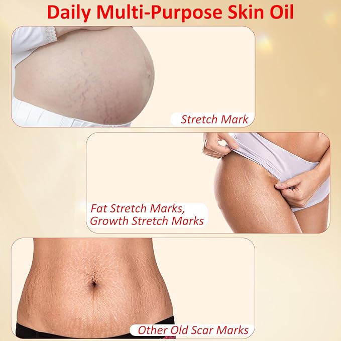 Stretch Mark Oil for Pregnancy, Skincare Body Oil for Scars and Stretchmarks, Pregnancy Oils for Stretch Marks Pre and Postpartum Natural Skincare Massage Oil, Skin Regenerate Oil, 4.2 fl.oz-Velvo Beauty