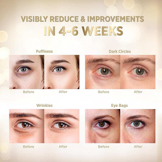 VELAMO ADVANCED Under Eye Patches: 24K Gold Under Eye Mask for Puffy - Retinol Patchology Eye Patches for Wrinkles and Dark Circles Puffiness- Collagen Under Eye Bags Treatment for Women Men 60 Pcs-Velvo Beauty