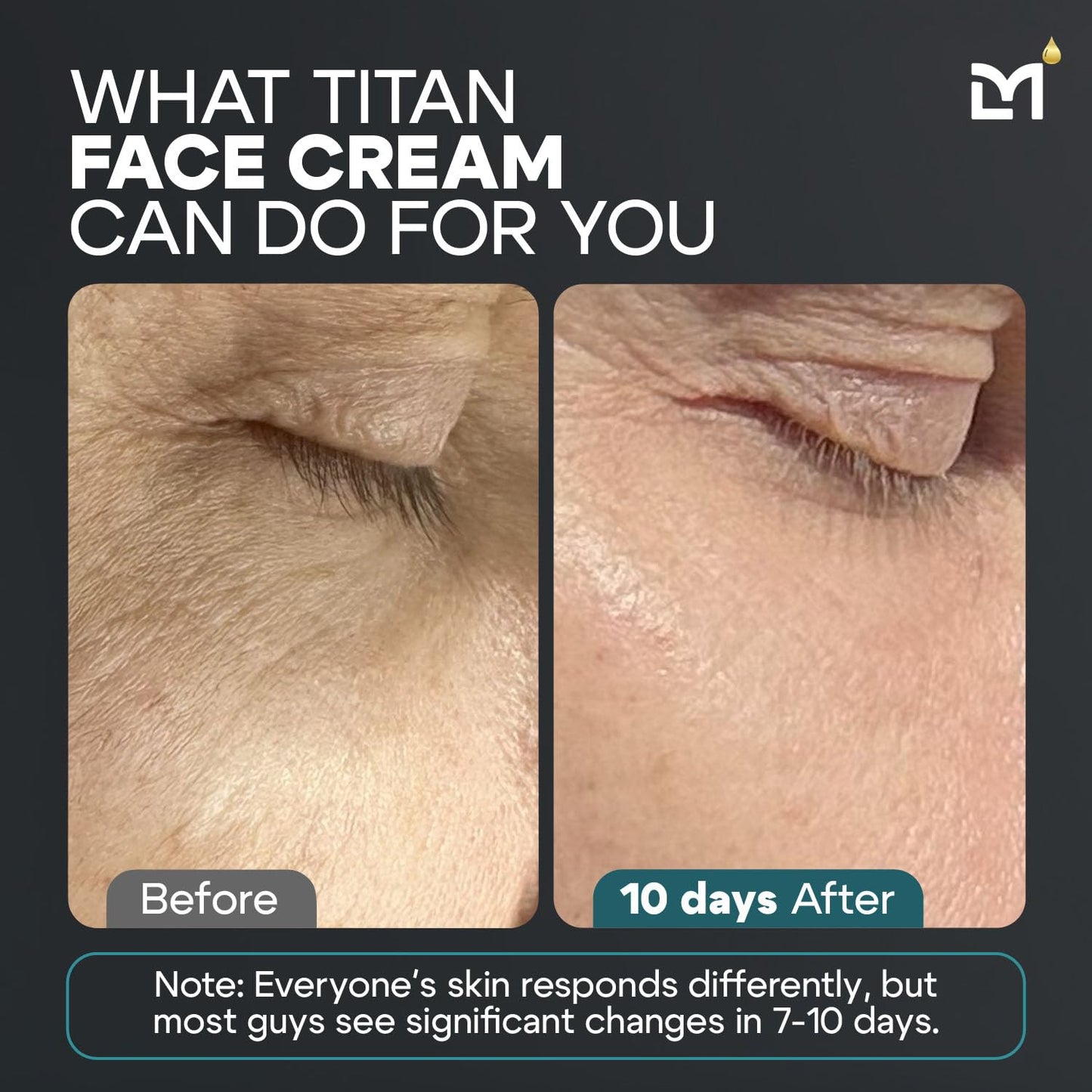 Titan Anti-Aging Mens Face Cream – Mens Face Moisturizer – For Men, Face Lotion – Men, Skin Care – Tighten, Tone, Revitalize – Ceramides, Vitamin C & E, Squalane – All Skin Types – Unscented-Velvo Beauty