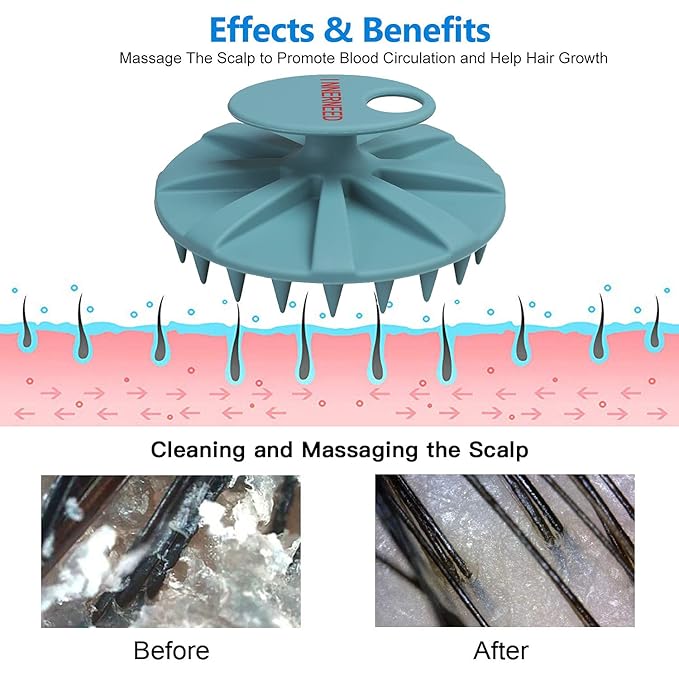 Scalp Massager Shampoo Brush, Wet & Dry Manual Scalp Care Head Scrubber Hair Washing, Soft Silicone Bristles, for Hair Growth, Dandruff Removal, Comfortable for All Hair Types (Dark Green+Gray)-Velvo Beauty