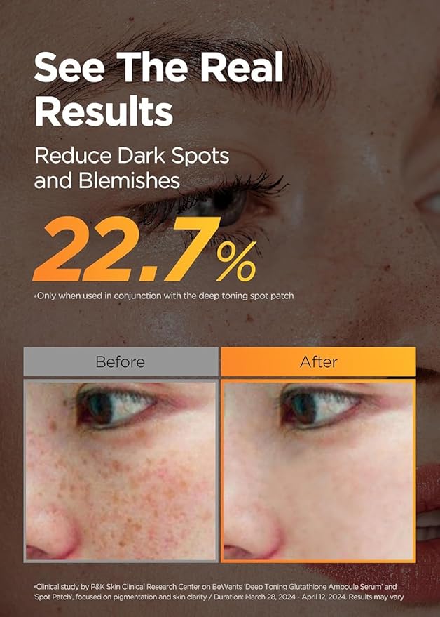 [K-Beauty] Bewants Deep Toning Glutathione Ampoule Serum | Korean Skincare with Vitamin C & Calendula Extract, 1.01 fl.oz & Bewants Deep Toning Glutathione Spot Patch-Velvo Beauty