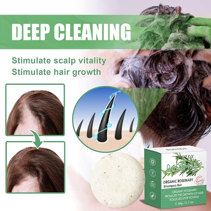 2 Pack Rosemary Shampoo Conditoner Bar Set,Thinning Hair-Volume Shampoo & Conditioner Bar for Men and Women,Hair Thickening & Regrowth Treatment,Hair Growth Soap for Anti-Hair Loss-Velvo Beauty