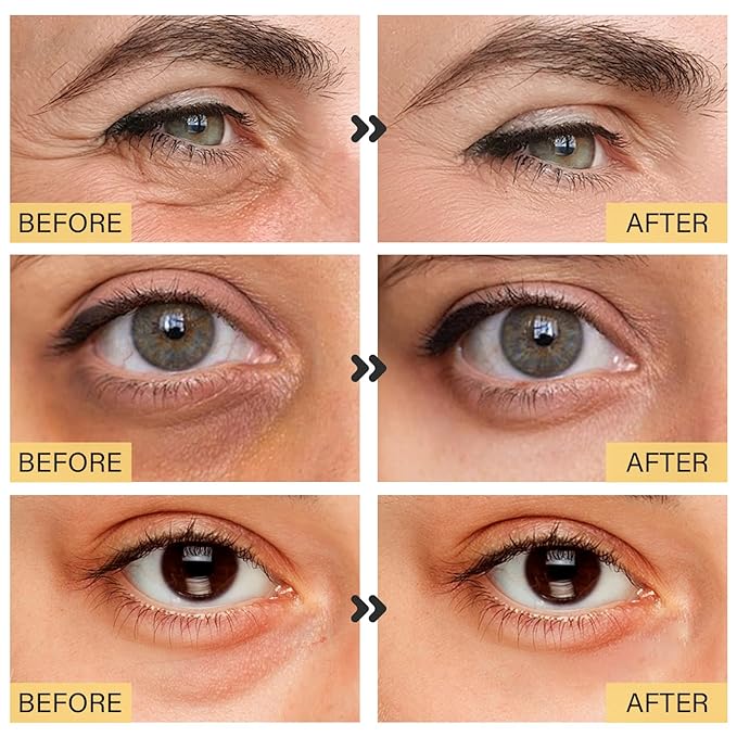 25 Paris Under Eye Patches Eye Mask for Puffy Eyes, Reducing Dark Circles, Anti-Aging & Refreshing, Collagen Eye Mask Eye Pads for Skin Care, 24K Gold-Velvo Beauty