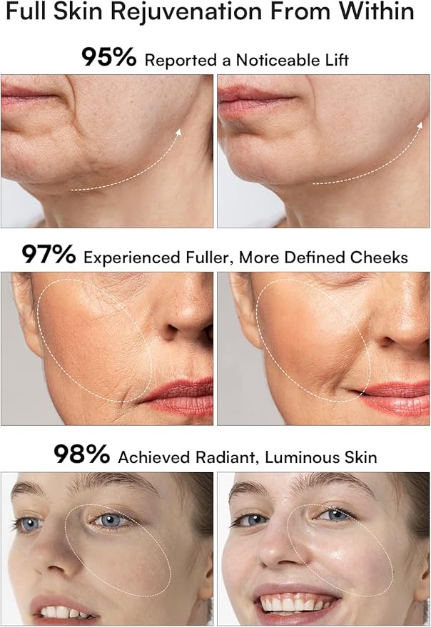 INIA 3-in-1 Red Light Therapy for Face and Neck Facial Massager True Beauty Glow Device, Lifting & Firming Skincare Tool-Velvo Beauty