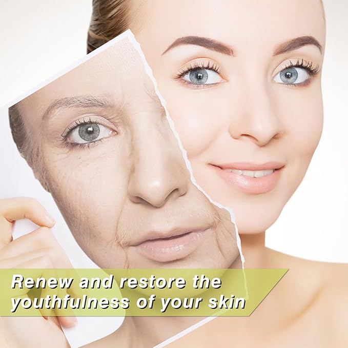 Elves Pdo Threads for Eyes Lift Mono Screw Type 30g25mm Pdo Lifting Thread for Fox Eye 40pcs Pdo Threads for Face Lift with Blunt Tips Smooting Eye Wrinkles Improves Skin's Firmness and Elasticity-Velvo Beauty