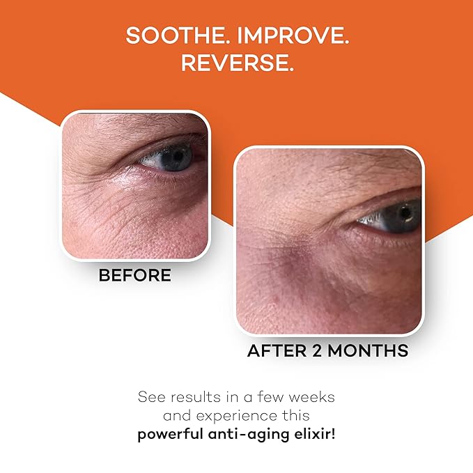 Zocufill Elixir Eye Gel and Face Serum - Eye Bags Treatment for Women and Men - Reduce the Appearance of Dark Circles, Puffy Eyes, Fine Lines and Wrinkles-Velvo Beauty