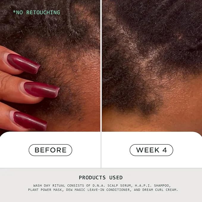 Sienna Naturals - D.N.A. Scalp Serum – Hair Growth Serum for Thinning Hair, Scalp Repair & Strength – Nourishing, Active Treatment for Scalp Health with Biotin & Rosemary– 1 oz-Velvo Beauty