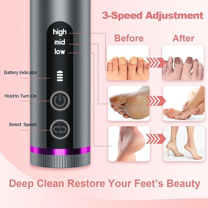 Electric Callus Remover for Feet, 3 Speeds Electric Foot Callus Remover with Powerful Brushless Motor, 2600mAh Runs for 7Hours, Washable Nano Glass Head, 60 Pcs Sandpaper Discs, Gift for Women & Men-Velvo Beauty