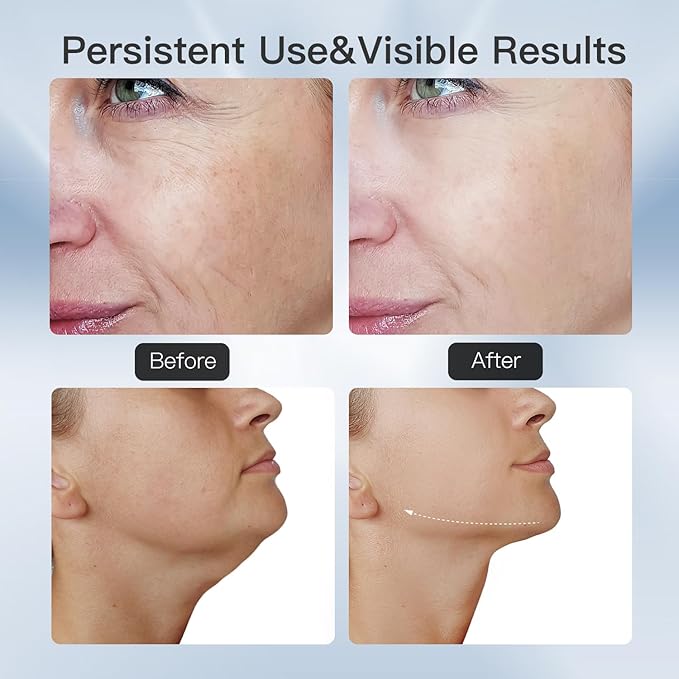 3-in-1 Beauty Massager for Face and Neck, Based on Triple Action LED, Thermal, and Vibration Technologies for Skin Care,Improve,Firm,Tightening and Smooth-Velvo Beauty