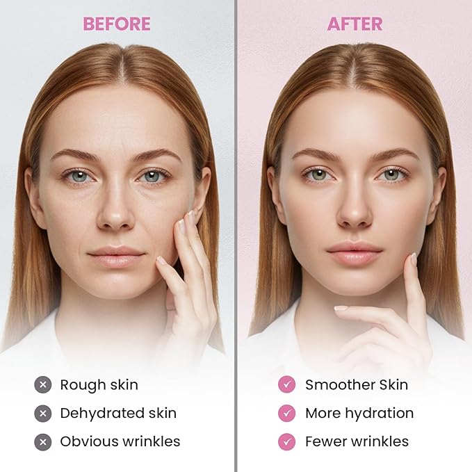 New Anti Facial Wrinkle Patches: Anti Wrinkle Patches Overnight - Smile Line Pathces - Facial Wrinkle Patche for Forehead, Smile Line, Under Eye 144 Pcs (1 Count (Pack of 144), Unscented)-Velvo Beauty