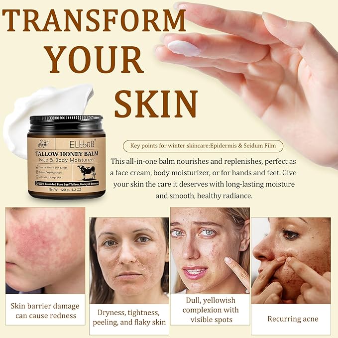 Whipped Tallow Cream for Face & Body - 100% Grass-Fed Beef Tallow, Natural Honey & Beeswax Moisturizer, Deep Hydration & Nourishment, Oil-Free & Unscented, Fast Absorbing-Velvo Beauty