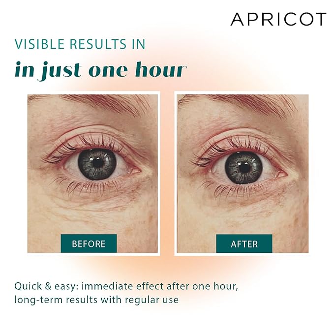 APRICOT Eye Patches with Hyaluronic Acid (pack of 1) I Anti-Aging Eye Pads "Me,Myself and Eye" I Reduces eye wrinkles I Reusable eye patches I Silicone pads against wrinkles I Made in Germany-Velvo Beauty