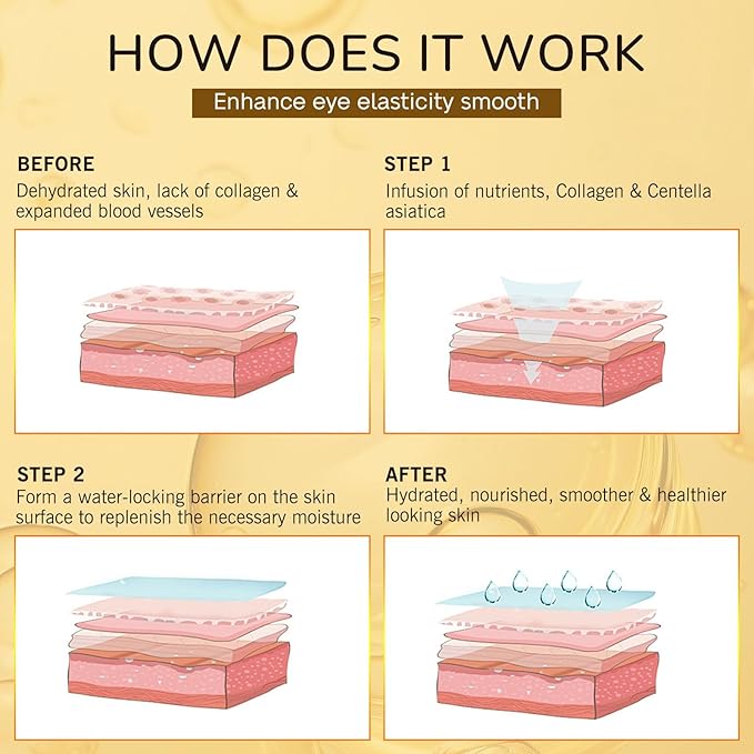 Under Eye Patches for Puffy Eyes and Dark Circles (20 Pairs), Under Eye Gold Mask with Hyaluronic Acid & Collagen to Reduce Wrinkles and Relieve Pressure, Eye Care Treatment for Men & Women Gift-Velvo Beauty