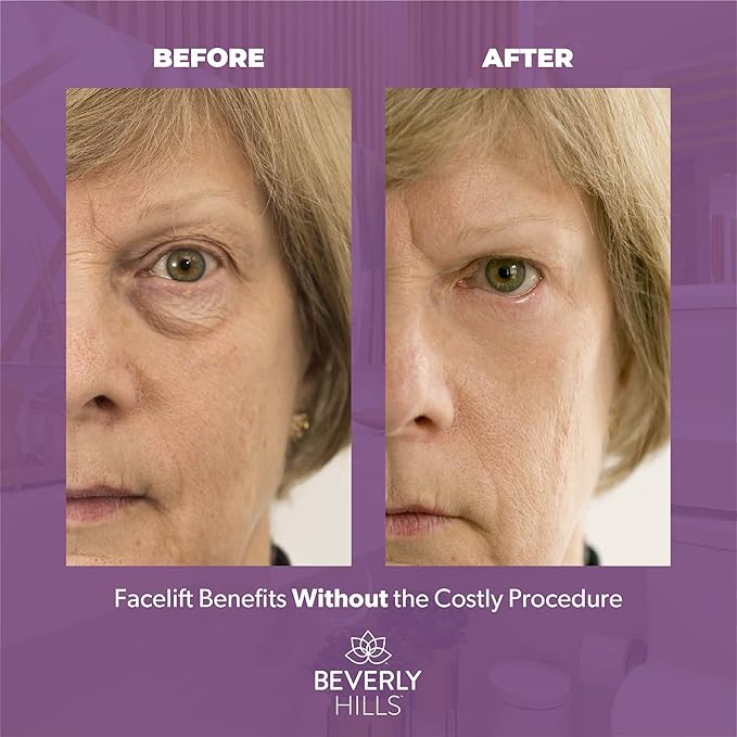 Beverly Hills V-Lift Instant Eye Lift and Eye Tuck Bee Venom Serum for Puffy Eyes, Dark Circles, Wrinkles, and Under Eye Bags Treatment for Women and Men | 30mL (120 Day Supply)-Velvo Beauty