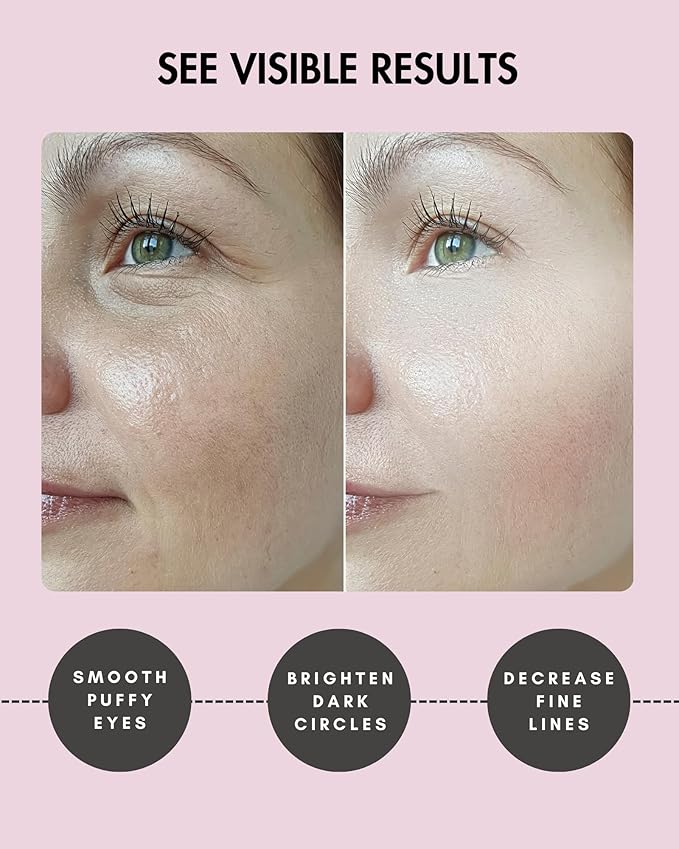 Under Eye Patches for Dark Circles and Puffiness - (15 pairs) Collagen Eye Masks with Natural Extracts for Wrinkle Reduction, Puffy Eyes & Eye Treatment Gels-Velvo Beauty