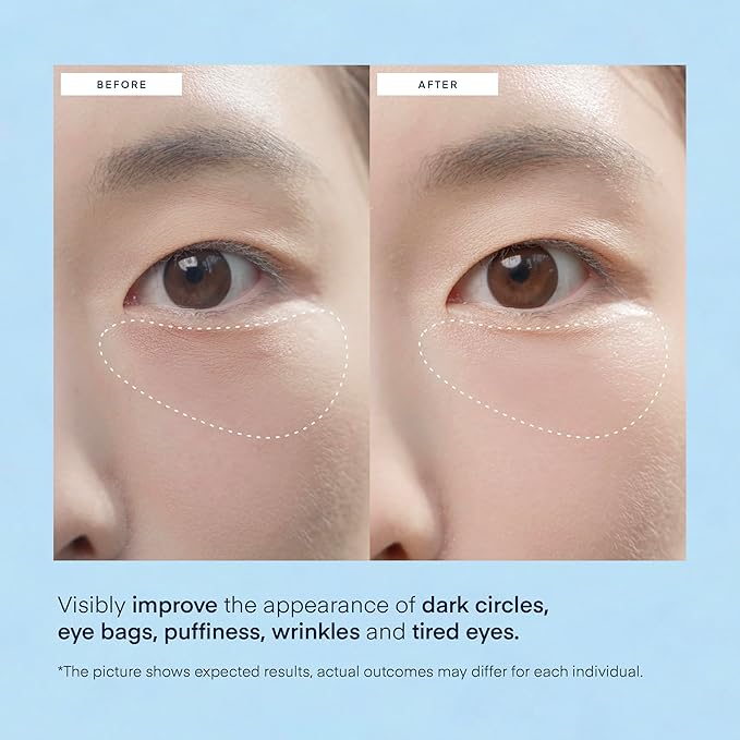 TEREZ & HONOR Under Eye Patches for Dark Circles - 60 Korean Hydrogel Masks for Puffiness, Bags with Caffeine, Hyaluronic Acid, Niacinamide - Undereye Brightening, Hydrating, Anti-Wrinkle & Cooling-Velvo Beauty