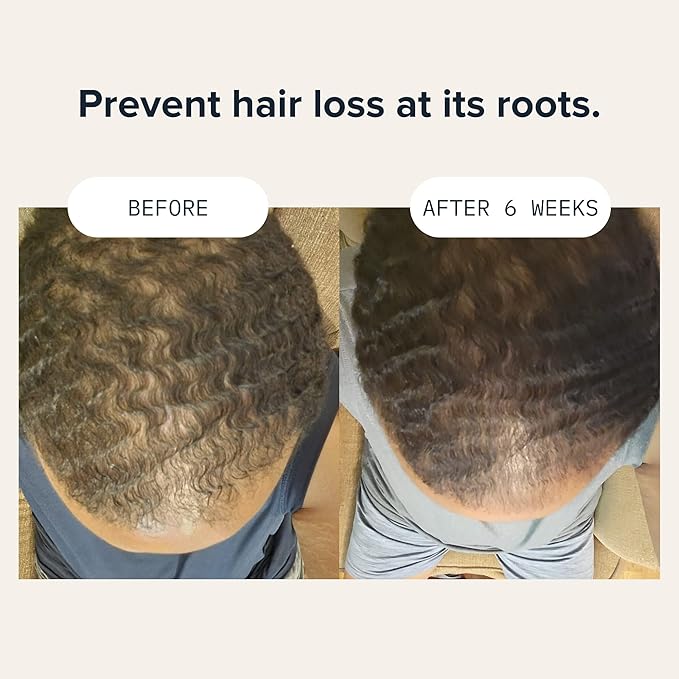 CARDON Hair Growth Shampoo for Men - Thickening, Anti-Thinning, Strengthens Roots, Korean Skincare for Healthy Scalp, Suitable for Oily and Dry Hair-Velvo Beauty