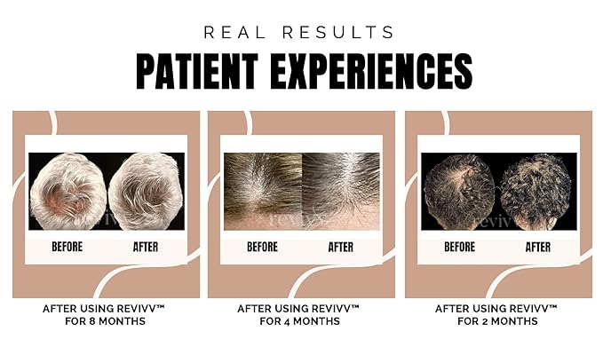 REVIVV Women's Hair Serum 2 Pack | Thicker, Fuller Hair with Our Natural Growth Products | Enhanced Scalp Health and Vitality | Combating Thinning & Packed with Vitamins-Velvo Beauty