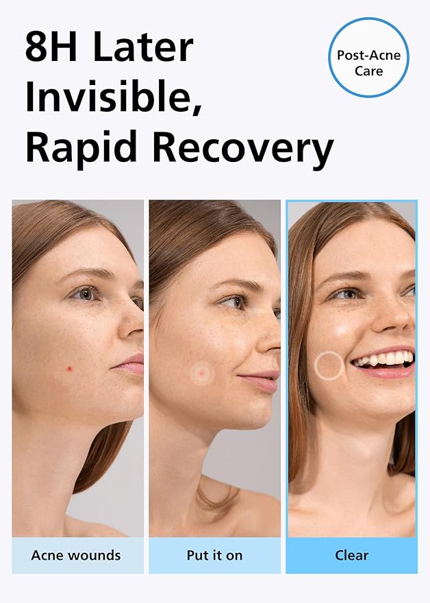 EasyDerm Beauty Patch(84 Counts) - 100% Hydrocolloid Pimple Patch for Zit Spot Care, K-beauty, Daewoong Pharmaceutical, Korean Acne Patches-Velvo Beauty