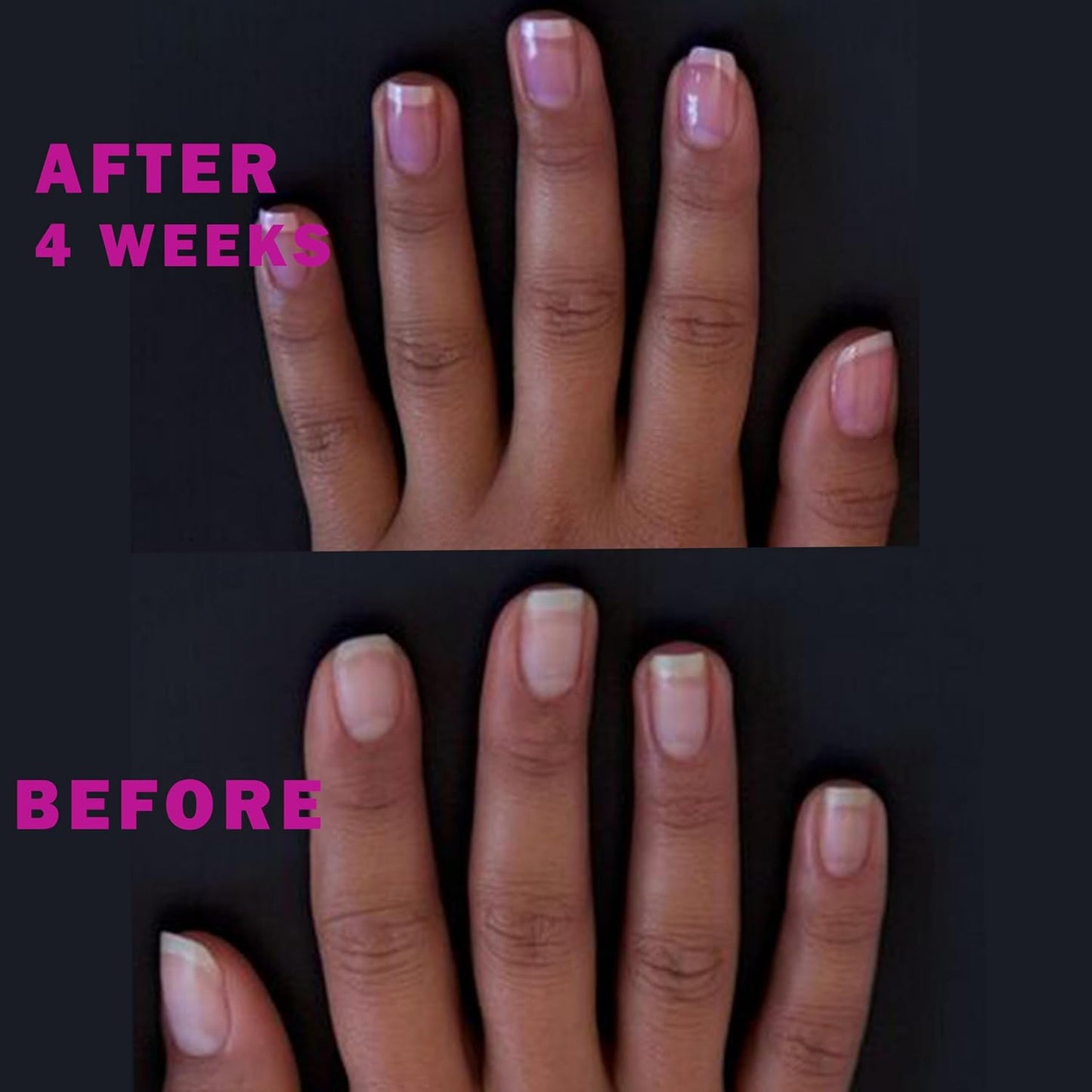 Perfect Formula Ruby Pink Gel Coat - Nail Strengthener, Keratin Nail Treatment, Gemstone Pink Gel Nail Polish - Nail Strengthener for Damaged Nails - Made In The USA .60 fl oz.-Velvo Beauty