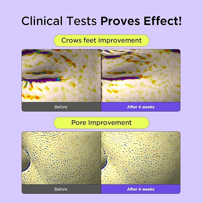 BY WISHTREND Vitamin A-mazing Bakuchiol Night Cream | Retinal, Peptide, Collagen, Ceramide NP, Centella Asiatica, moistfully plump overnight skincare (1.05 Ounce (Pack of 1))-Velvo Beauty