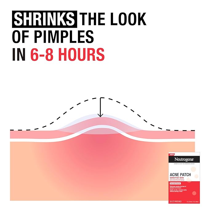 Neutrogena Sensitive Skin Blemish Patches, Acne Patches for Sensitive Skin, Hydrocolloid Treatment Visibly Shrinks Pimples Overnight, 2 Sizes, 30 Count-Velvo Beauty