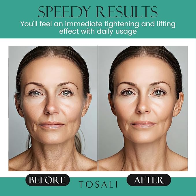 Anti Aging Face Cream for Women, 1.7 oz - Niacinamide Cream, Hydrating Face Moisturizer with Multivitamins - Day & Night Cream for Face with Anti Aging Effect, Skin Care for All Skin Types-Velvo Beauty