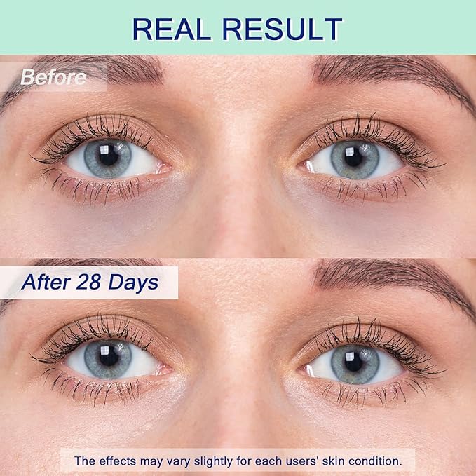 Eye Serum for Dark Circles, 5% Caffeine Under Eye Cream for Wrinkles, Morning Puffiness and Fine Lines, Deeply Repairs the Muscles Around the Eyes with 360°Massage Ball, 0.5 Fl Oz-Velvo Beauty