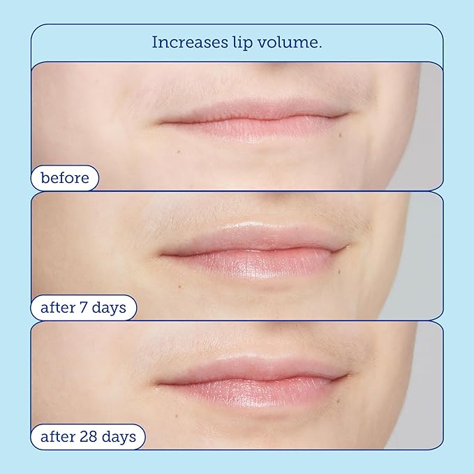 Skinfix Barrier+ Triple Lipid Lip Treatment: Nourish Dry, Chapped Lips With Our Volumizing Complex to Visibly Plump & Fill Fine Lines, 0.27 Oz-Velvo Beauty