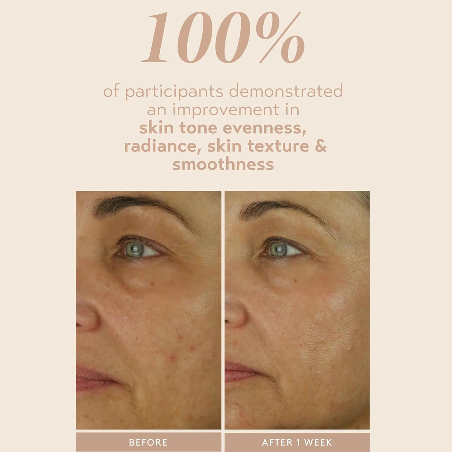 SHANI DARDEN SKIN CARE Retinol Reform with 1% Encapsulated Retinol Serum for Face & Neck, Gentle Slow-Release Face Serum with Tripeptide for Wrinkles, Fine Lines & Uneven Tone, 1 fl oz-Velvo Beauty