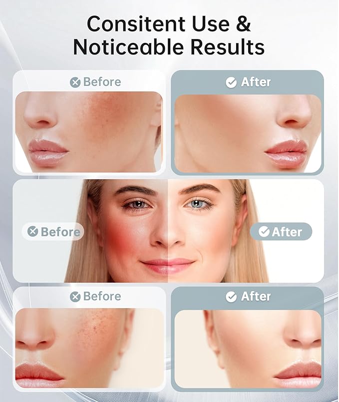 Red Light Therapy for Face and Neck, 7 Color Facial Massager with Adjustable Vibration and Thermals for Wrinkles, Double Chin, Portable Skin Care Tool with Base, White-Velvo Beauty