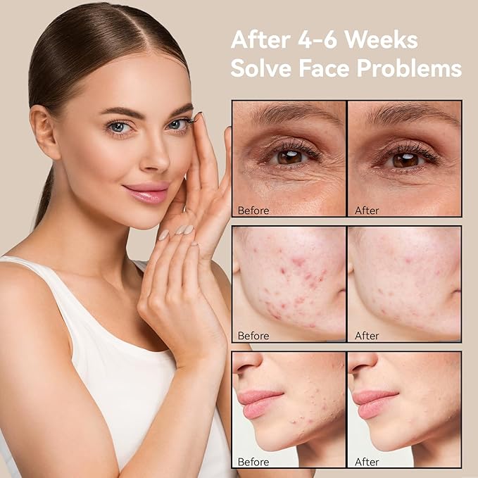 7 Colors Led Light Therapy Facial Mask, Face Light Therapy Mask for Face, Reduce Wrinkles Smooth Skin, Infrared Light Skin Rejuvenation-Velvo Beauty