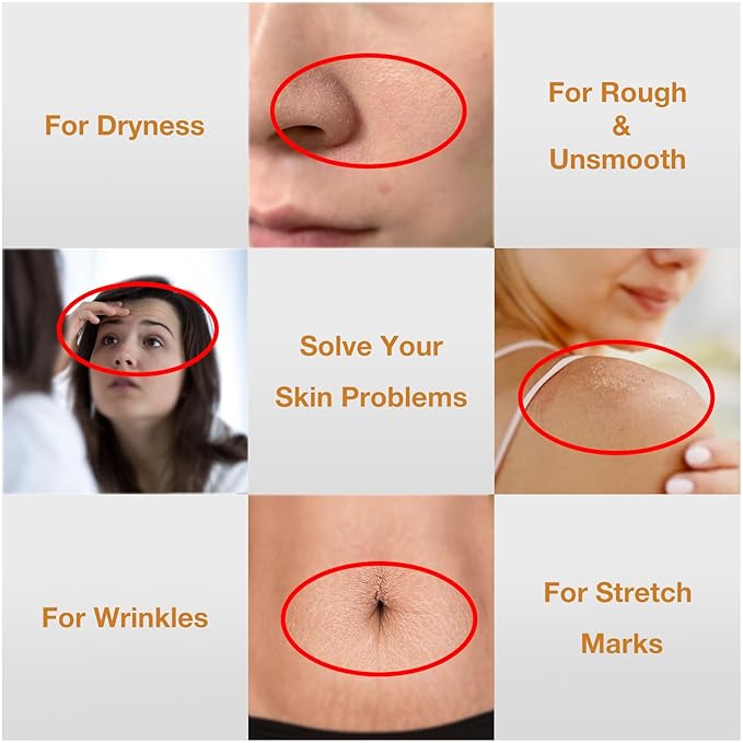 2PCS Folic Acid&Amino Acid,Essence combination of oil and lotion,Age-Defying Vegetable Glycerine for Skin Firms, Smooth, Anti Stretch Mark, Moisturizing 6.7 OZ +3.7 OZ-Velvo Beauty