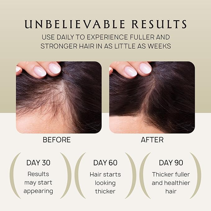 Hair Growth Oil Spray - 100% Pure Ingredients For Non Greasy, Thicker & Stronger Hair - Organic Batana, Castor, Biotin, Saw Palmetto, and Rosemary Oil for Men & Women Scalp - 4 FL OZ-Velvo Beauty