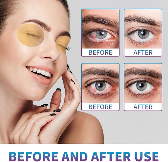 Eye Care Patch 20PCS Eye Pads for Tired Eyes & Dry Eyes Eye Cooling Pads for Puffy Eyes, Office Eye Relief & Refresh Refresh and Revitalize Tired Eyes-Velvo Beauty
