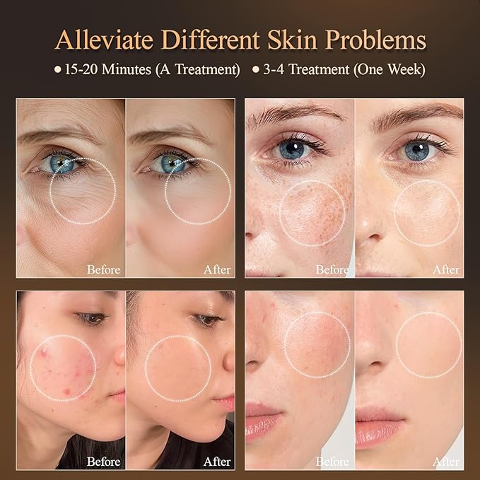 7 Colors Led Light Therapy Facial Mask, Face Light Therapy Mask for Face, Reduce Wrinkles Smooth Skin, Infrared Light Skin Rejuvenation(White)-Velvo Beauty