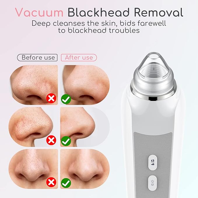 Blackhead Remover Vacuum, Black Head Remover for Face with Camera, Pore Vacuum for Men and Women, USB Interface Type Blackhead Remover Tools, 6 Suction Heads & 3 Adjustment Modes (Grey)-Velvo Beauty