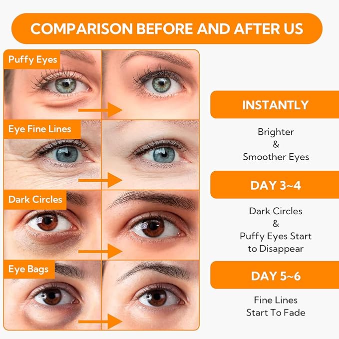 Vitamin C Under Eye Patches(30 Pairs) -Cooling Eye Masks for Dark Circles, with Caffeine Niacinamide Hydra-Gel Collagen, Puffy Eyes & Eye Bags Treatment, Fine Lines & Wrinkles Reduce, Anti-Aging-Velvo Beauty