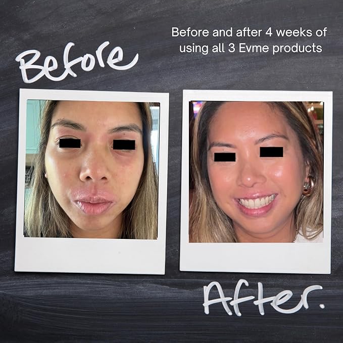 Evme Skincare Kit – Gentle Cleanser, Hydrating Serum & Night Cream – Nourishing for Sensitive Skin, Aiming for Sans-allergenic, Dermatologist-Tested, Fragrance-Free, Made in USA-Velvo Beauty