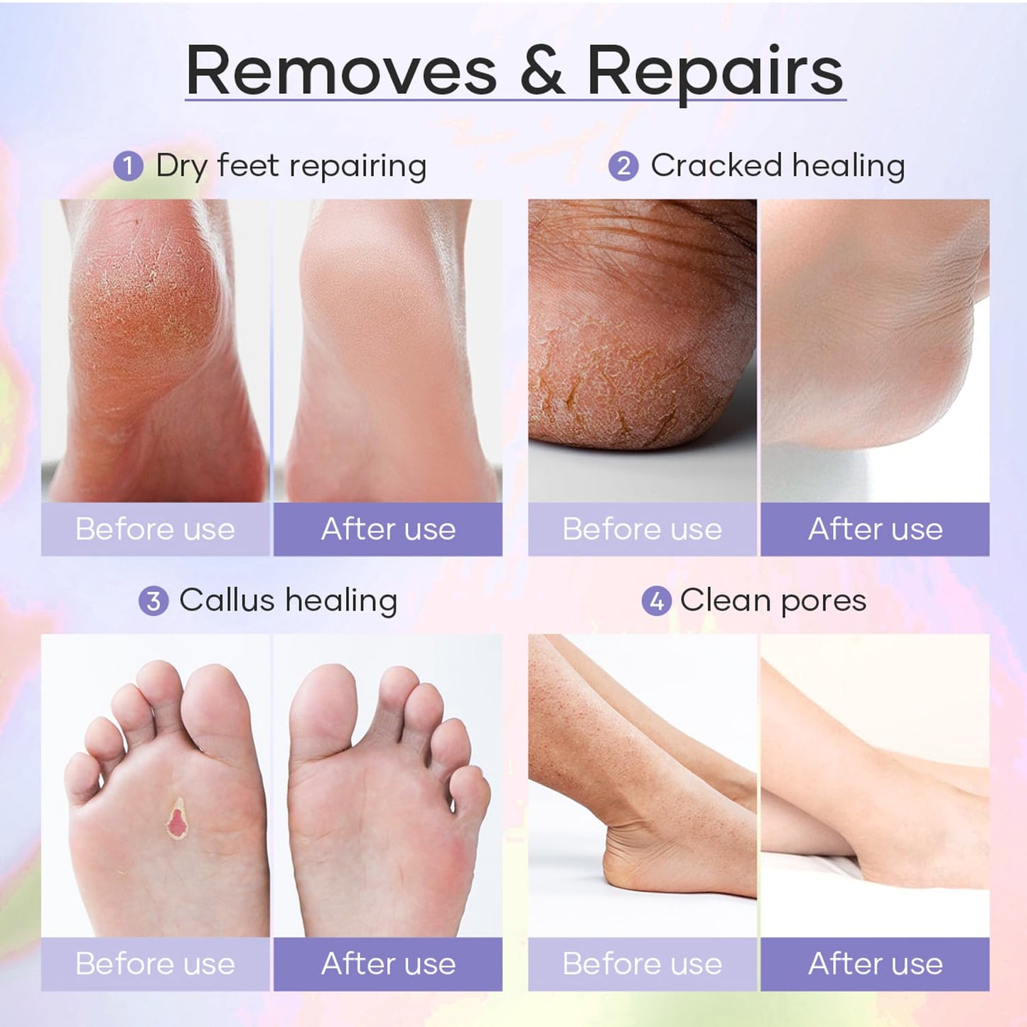 Epsom Salt Soak, Callus Remover Gel, Extreme Sugar Scrub, Collagen Mask & Shea Butter Lotion – Professional Spa Foot Care System 5 Step Luxury Pedicure Kit. Orange 03 Set-Velvo Beauty