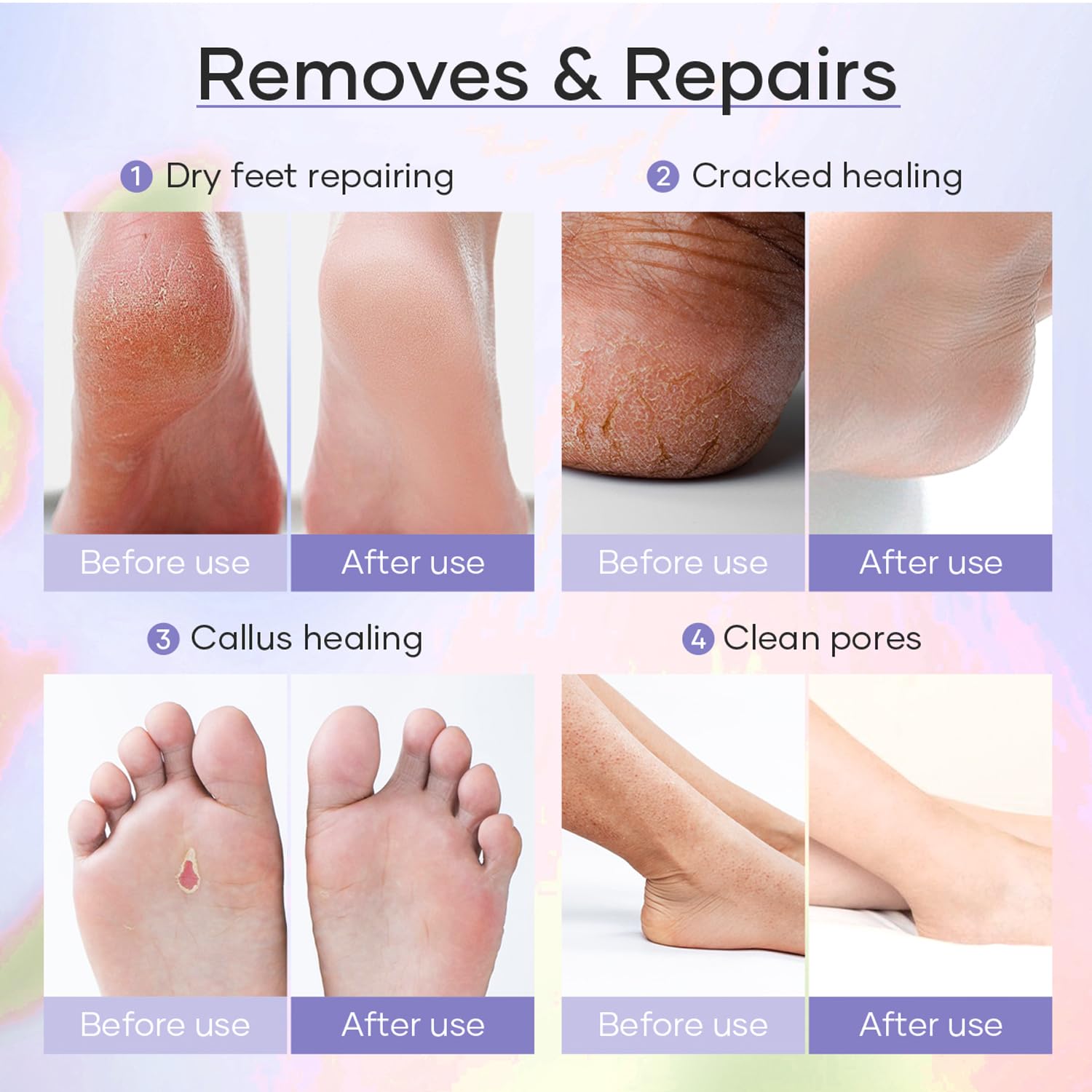 Epsom Salt Soak, Callus Remover Gel, Extreme Sugar Scrub, Collagen Mask & Shea Butter Lotion – Professional Spa Foot Care System 5 Step Luxury Pedicure Kit. Orange 03 Set-Velvo Beauty