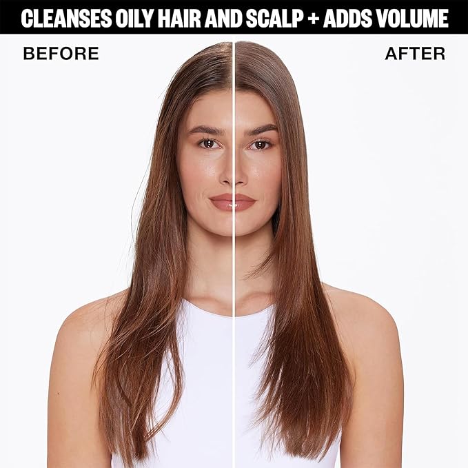 IGK FIRST CLASS Charcoal Detox Dry Shampoo | Volume + Soothes Scalp + Balance Oil | Vegan + Cruelty Free | 6.3 oz (Pack of 2)-Velvo Beauty