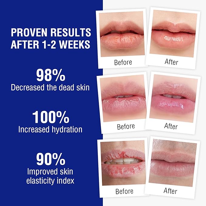 Lip Balm Treatment with Beeswax, Peppermint Oil,Natural Formula Lip Balm with Vitamin E & C Lips Daily Conditioning 24 hrs Long-lasting Moisture, Gentle Exfoliation Prevent Dryness & Chapping-Velvo Beauty