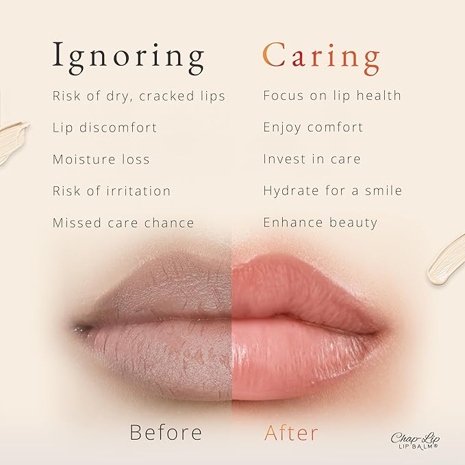 CHAP-LIP Original Lip Balm Hydrating Bulk Chap Stick with Fruit Flavors, Coconut Oil, and Cocoa Butter - Lip Therapy Pack for Men and Women - Gift Set Made in the USA, 24 Pack-Velvo Beauty